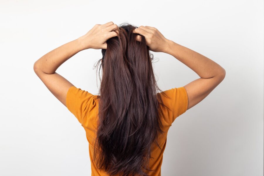 Hair Restoration for Women with Autoimmune Diseases- A Path Back to Confidence