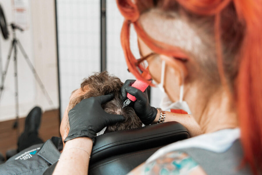 Hair Transplants and Tattoo Cover-Ups- Combining Solutions for Confidence