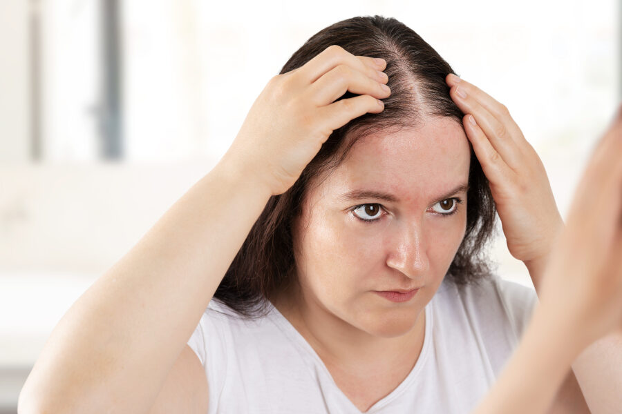 How to Prevent Hair Thinning in Your 30s and 40s